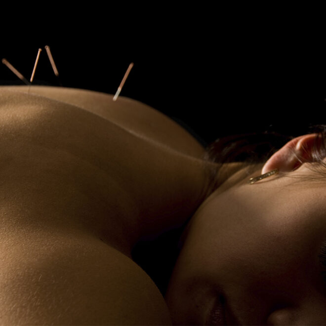 6 usos de la acupuntura que debes conocer