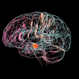 Avances en el combate contra el Parkinson