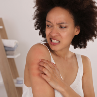 Alergia a flor de piel: el eccema