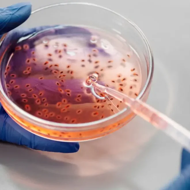 Bacterias orales podrían estar vinculadas al desarrollo del Parkinson Bacterias orales podrían estar vinculadas al desarrollo del Parkinson