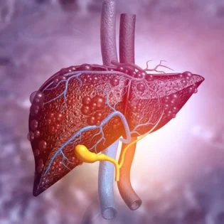 Hepatitis tóxica: ¿qué hierbas y suplementos dañan el hígado y por qué evitarlos?