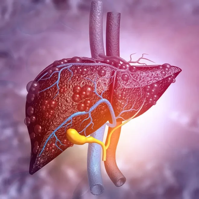 Hepatitis tóxica: ¿qué hierbas y suplementos dañan el hígado y por qué evitarlos? Hepatitis tóxica: ¿qué hierbas y suplementos dañan el hígado y por qué evitarlos?